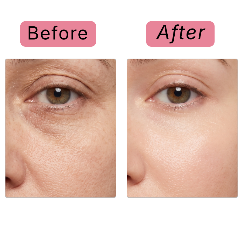 Before and after: eye area transformation